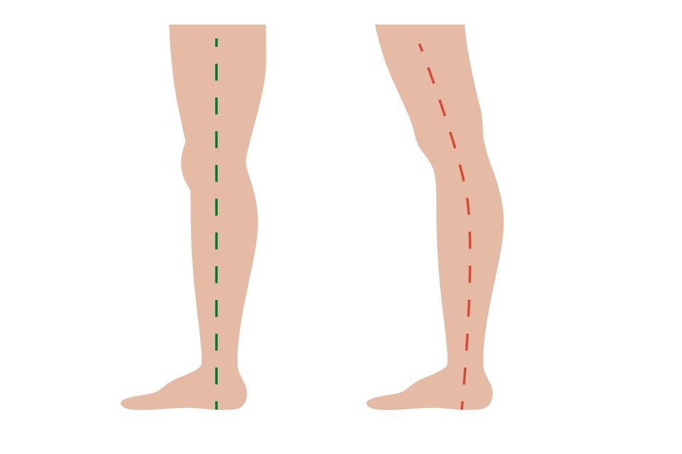 Hypermobility is different to flexibility